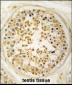 EARS2 Antibody (C-term)